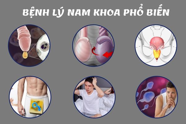 Một số bệnh lý nam khoa phổ biến hiện nay