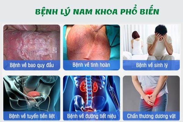 Các bệnh lý nam khoa phổ biến nhất ở nam giới