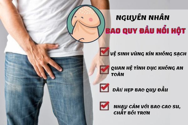 Có nhiều nguyên nhân dẫn đến bao quy đầu nổi hột