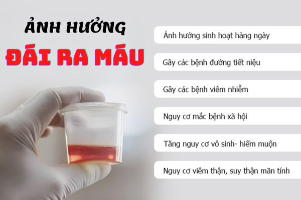 Đái ra máu gây ra những ảnh hưởng nhất định đối với cơ thể