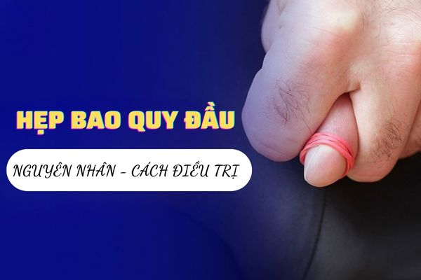 Hẹp bao quy đầu nam giới là gì? Nguyên nhân và cách điều trị