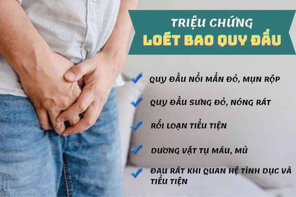 Loét bao quy đầu ở nam giới có nhiều dấu hiệu nhận biết khác nhau