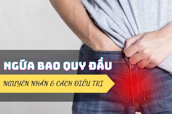 Nguyên nhân ngứa bao quy đầu – Cách điều trị hiệu quả