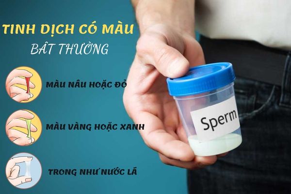 Tinh dịch có màu bất thường đáng lưu ý