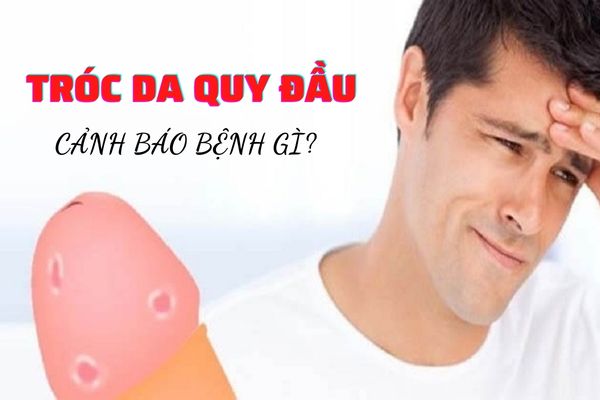 Tróc da quy đầu cảnh báo bệnh gì? Cách khắc phục hiệu quả