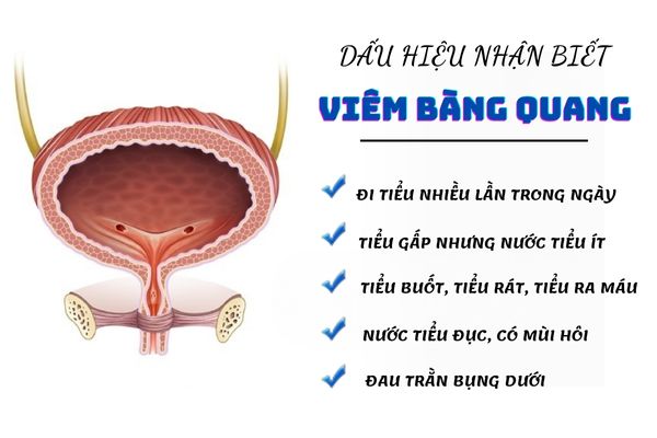 Dấu hiệu nhận biết viêm bàng quang cần lưu ý