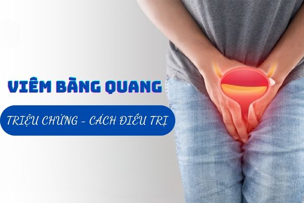 Bệnh viêm bàng quang là gì? Dấu hiệu và cách chữa trị