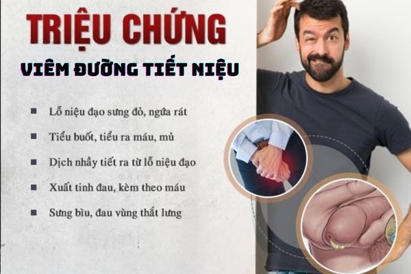 Dấu hiệu nhận biết viêm đường tiết niệu cần lưu ý