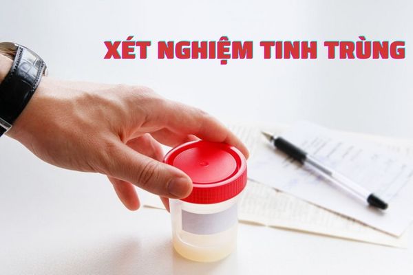 Xét nghiệm tinh trùng – Phương pháp đánh giá sức khỏe sinh sản hiệu quả