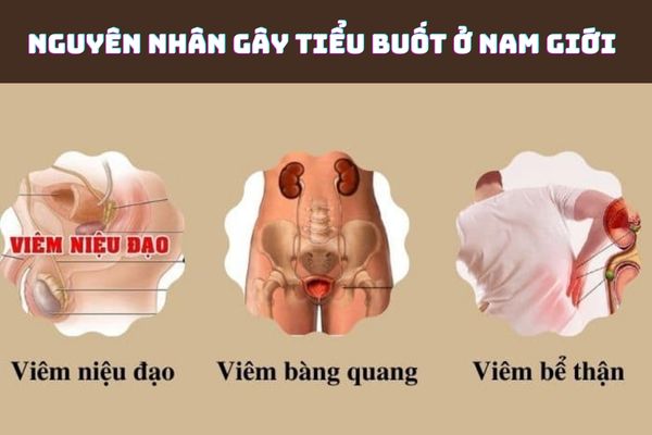 Tiểu buốt do nhiều bệnh lý khác nhau gây nên