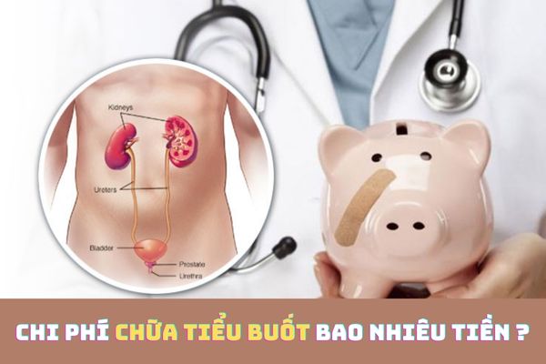 Chi phí chữa tiểu buốt hiện nay bao nhiêu tiền?