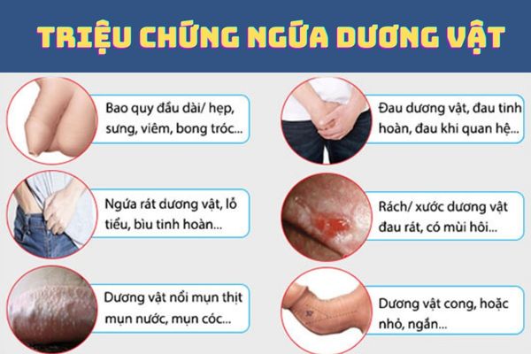 Dấu hiệu nhận biết ngứa dương vật thường gặp ở nam giới