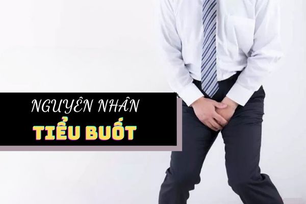 Nguyên nhân tiểu buốt do đâu – Cách điều trị hiệu quả