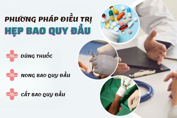 Phương pháp điều trị bệnh hẹp bao quy đầu ở nam giới