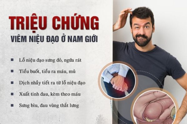 Triệu chứng nhận biết viêm niệu đạo thường gặp