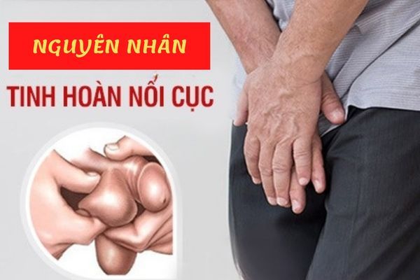 Nguyên nhân tinh hoàn nổi cục – Có nguy hiểm không?