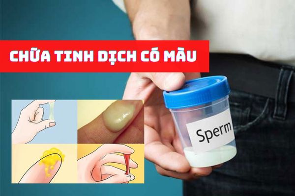 Nhận biết và chữa tinh dịch có màu đúng cách, hiệu quả