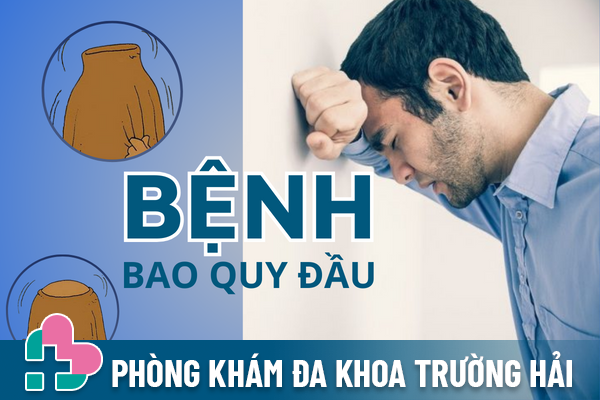 Cần biết gì về bệnh bao quy đầu?