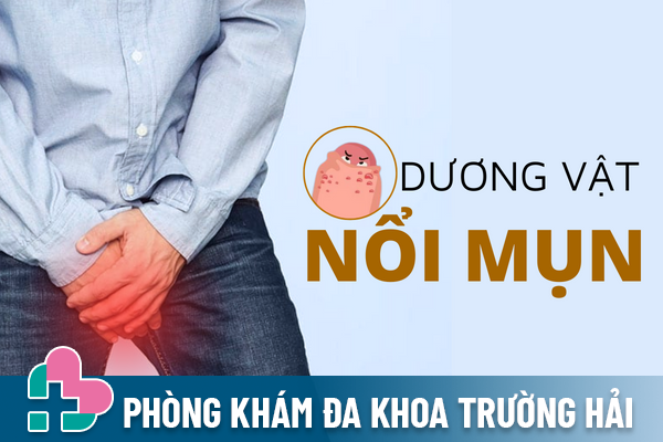 Dương vật nổi mụn – Cảnh báo các bệnh lý nguy hiểm