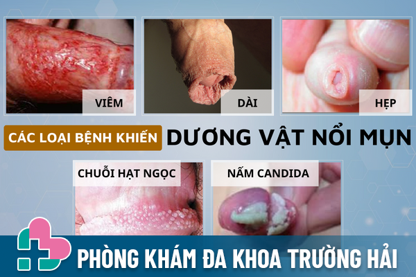 Duong-vat-noi-mun-canh-bao-cac-benh-ly-nguy-hiem-1