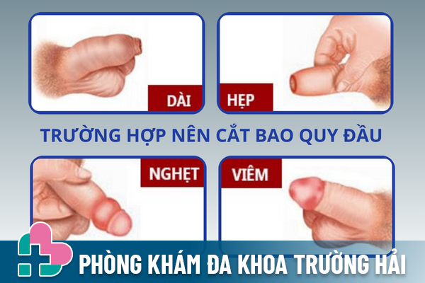 Tat-tan-tat-ve-phuong-phap-cat-bao-quy-dau-1