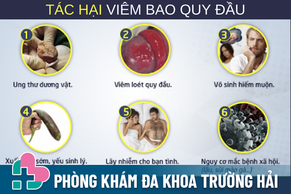 Viem-bao-quy-dau-cam-giac-kho-chiu-keo-theo-nguy-hiem-2