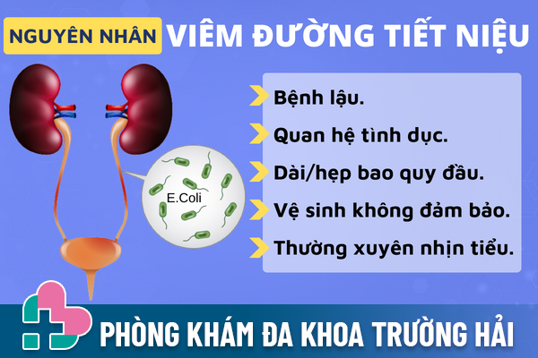 Viem-duong-tiet-nieu-va-nhung-luu-y-can-nho-1