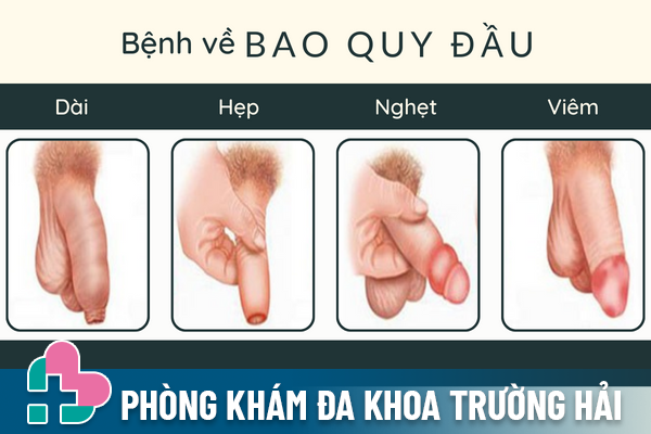 10-benh-nam-khoa-thuong-gap-can-het-suc-luu-y-2