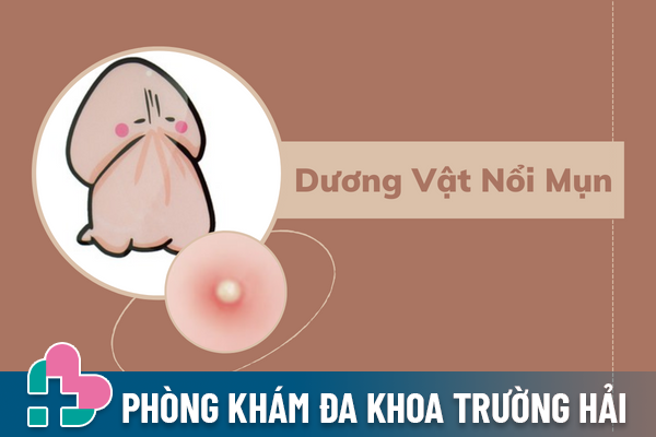 Dương vật nổi mụn là do đâu và điều trị ra sao?