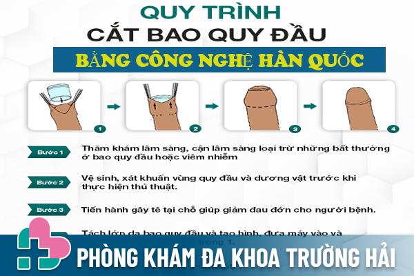 Quy trình cắt bao quy đầu bằng phương pháp tiên tiến không đau tại Trường Hải