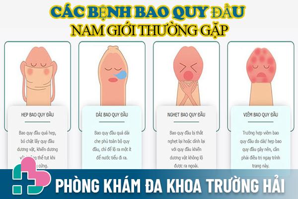 [Xem ngay] Các bệnh bao quy đầu ở nam giới thường gặp