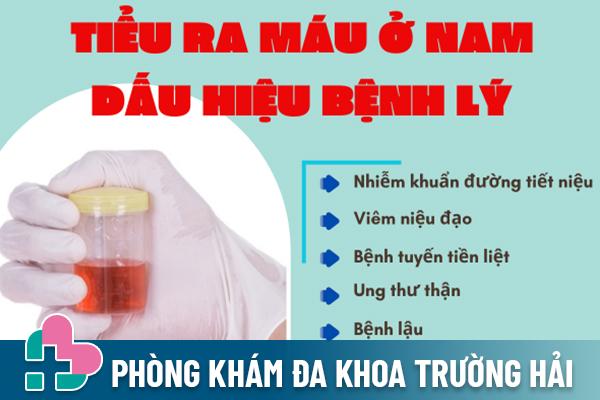 Cảnh báo hiện tượng tiểu ra máu ở nam giới