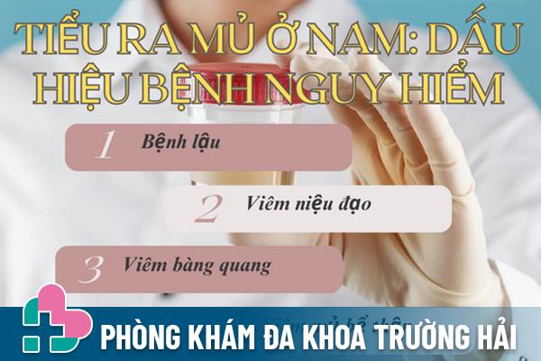 Tiểu ra mủ ở nam: Dấu hiệu bệnh nguy hiểm