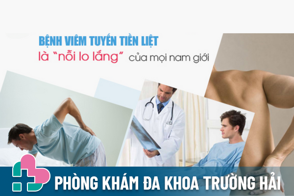 Bệnh viêm tuyến tiền liệt là gì? và điều trị thế nào?