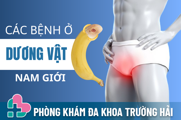 Các bệnh ở dương vật nam giới cần lưu ý.