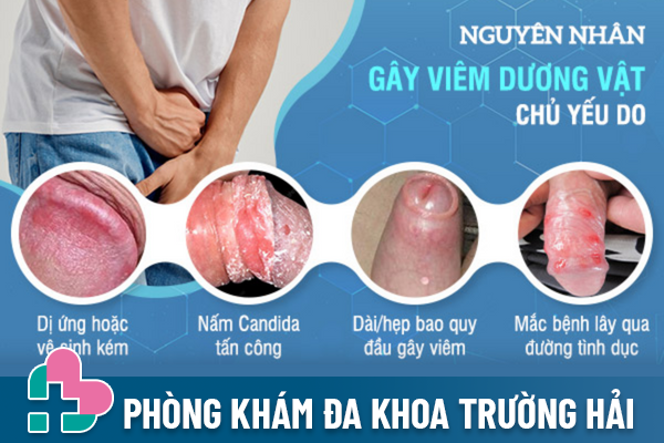 Cac-benh-o-duong-vat-nam-gioi-can-luu-y-1