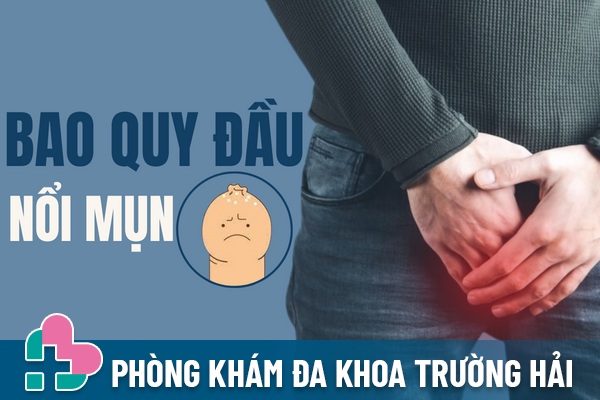 Đừng chủ quan khi bao quy đầu nổi mụn.