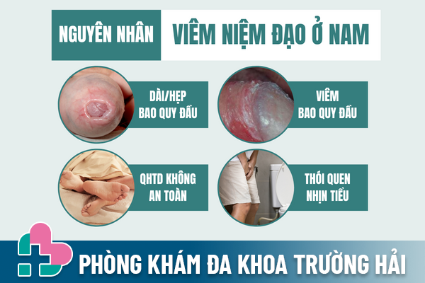 Dung-xem-nhe-viem-nieu-dao-o-nam-2