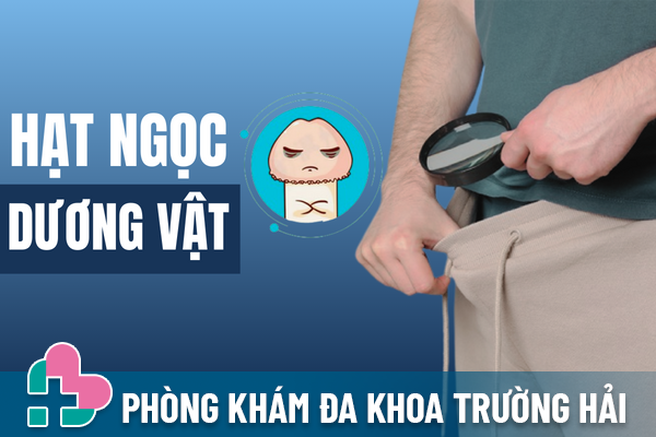 Hạt ngọc dương vật có lây không?