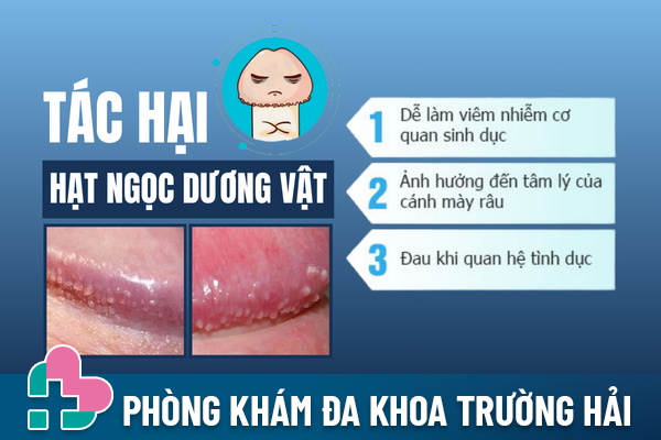 Hat-ngoc-duong-vat-co-lay-khong-03