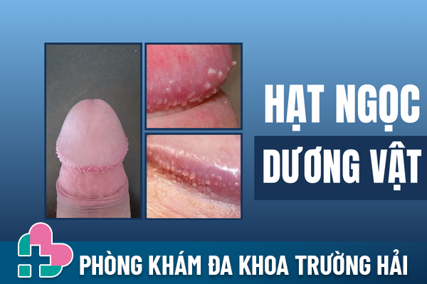 Hat-ngoc-duong-vat-co-lay-khong-1