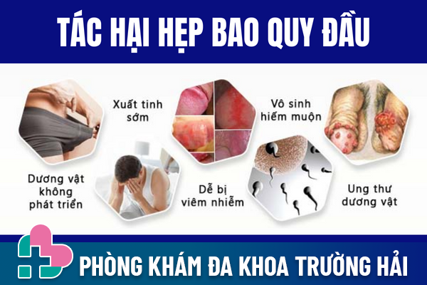 Hep-bao-quy-dau-hoi-chung-nguy-hiem-pho-bien-o-nam-gioi-3