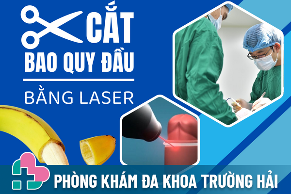 Phuong-phap-cat-bao-quy-dau-bang-laser-0