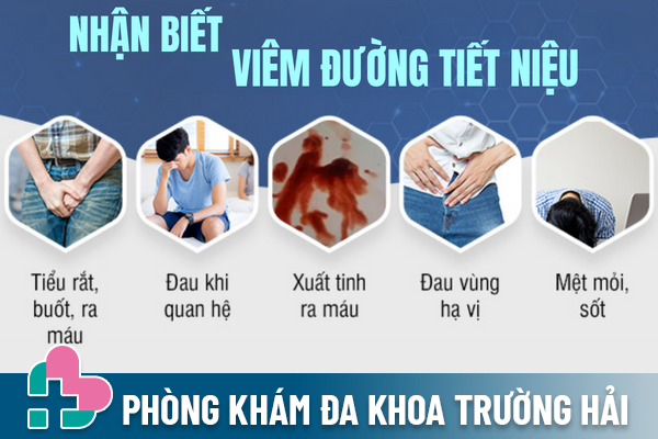 Biet-ro-viem-duong-tiet-nieu-nam-giup-tri-hieu-qua-2