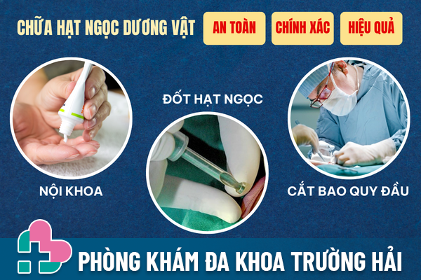 Chua-hat-ngoc-duong-vat