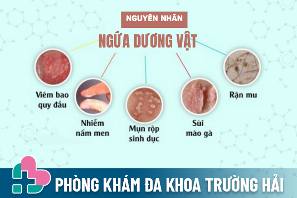 Dau-la-nguyen-nhan-ngua-duong-vat-2