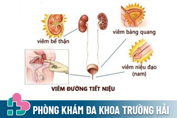 Dia-chi-chua-viem-duong-tiet-nieu-nam-uy-tin-1