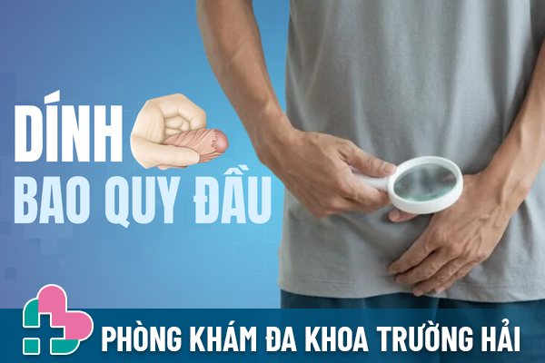 Hiểu đúng về dính bao quy đầu để trị đúng cách.