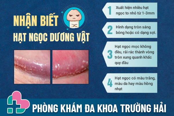 Nhan-biet-hat-ngoc-duong-vat