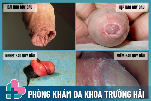 Xac-dinh-thu-pham-bao-quy-dau-noi-man-do-de-tri-hieu-qua-1